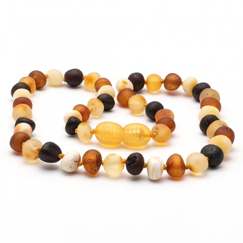 Baroque Amber Teething Necklace